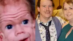Yaşlı Doğup Gençleşen Adam: Benjamin Button Gerçeği Mi?