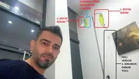 Sarı Serum Ölümüne Soruşturma